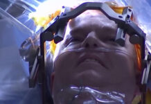 Reuters: в Neuralink знали о недостатках вживленного в мозг пациента чипа